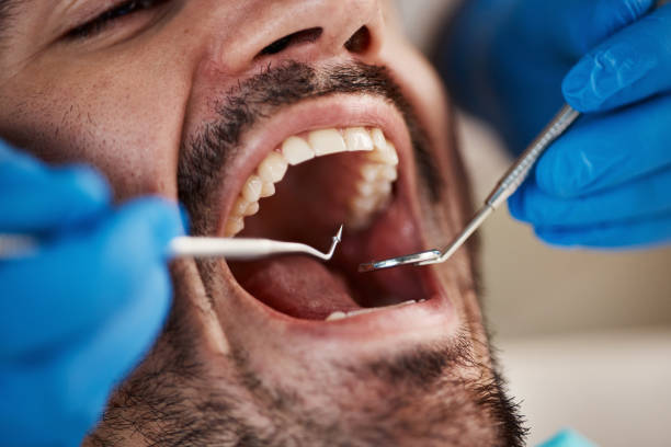 Best Broken or Chipped Tooth Repair in Richardson, TX